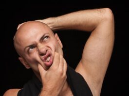 Can psoriasis cause baldness?