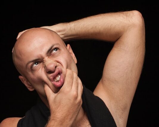 Can psoriasis cause baldness?